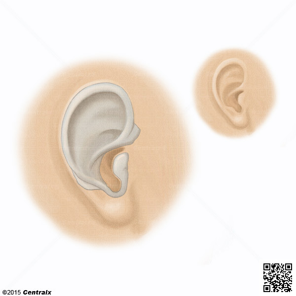 Cartilage oreille