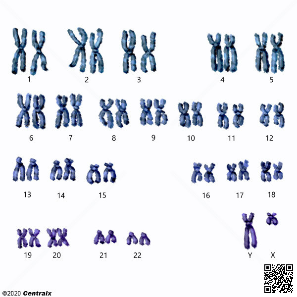 Chromosomes humains