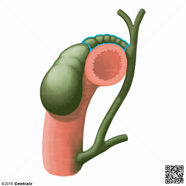 Conduit cystique