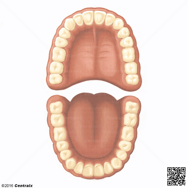 Denture permanente
