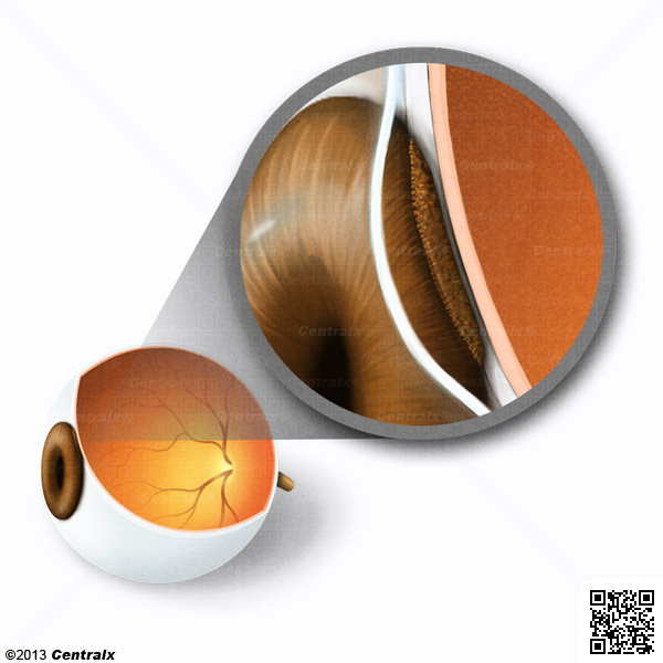 pithlium pigmentaire oeil
