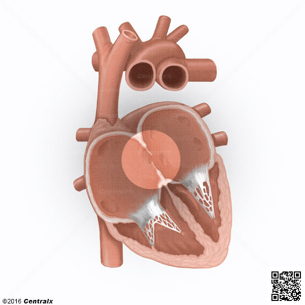Foramen ovale