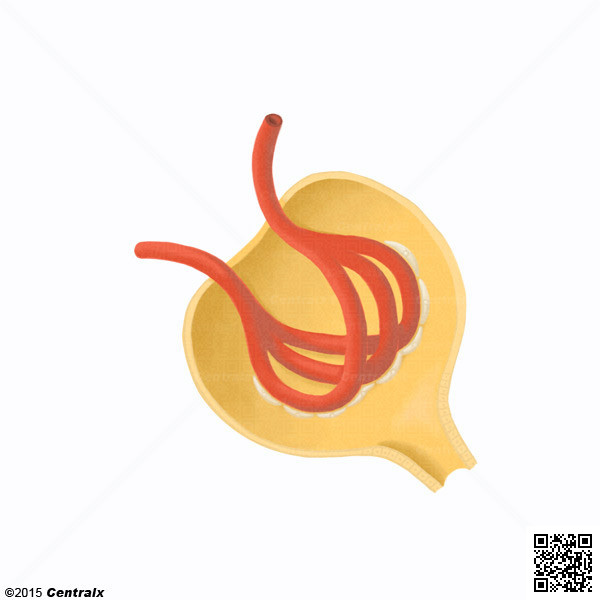 Membrane basale glomrulaire