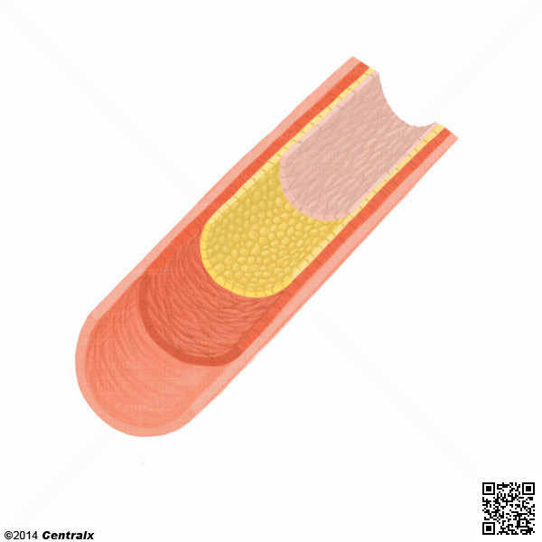 Endothlium vasculaire