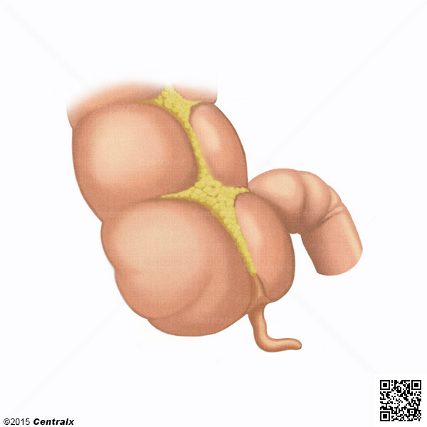 Appendice vermiforme