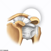 Articulation acromioclaviculaire