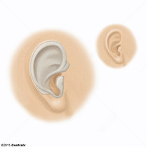 Cartilage oreille