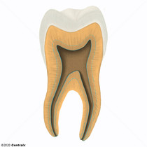 Dentine secondaire