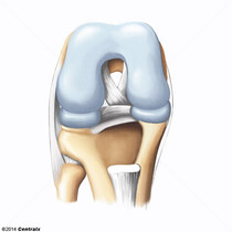 Cartilage hyalin